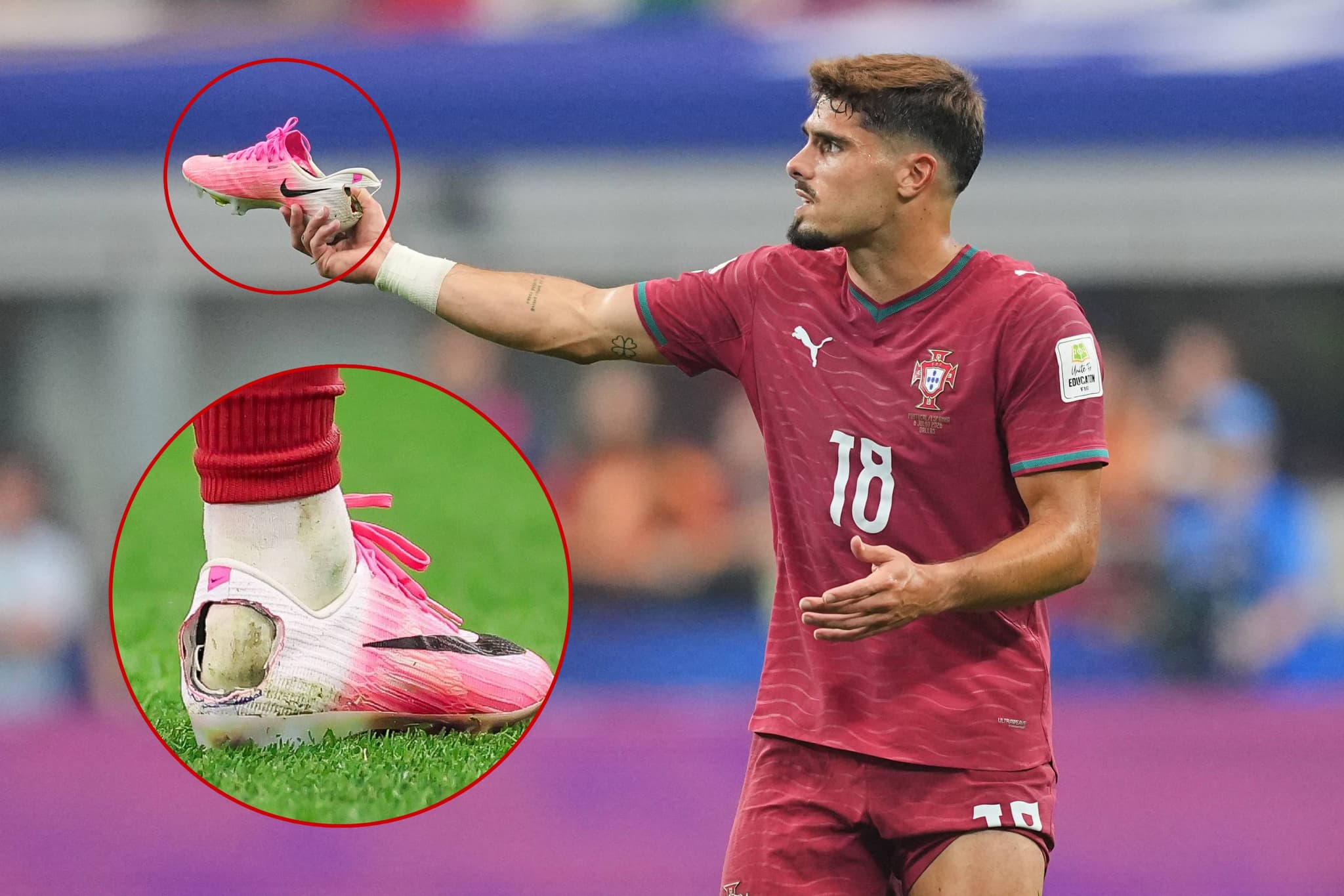 El síndrome de Haglund responde a la imagen viral de la bota rota de Pedro Neto